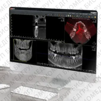 Программное обеспечение для обработки снимков зубов QuickVision 3D