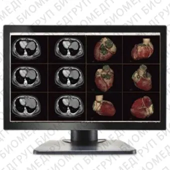 Double Black Imaging Image Systems Gemini 6MP Large Format Display Медицинский монитор