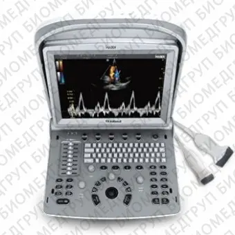 Переносной ультразвуковой сканер SonoRad K9