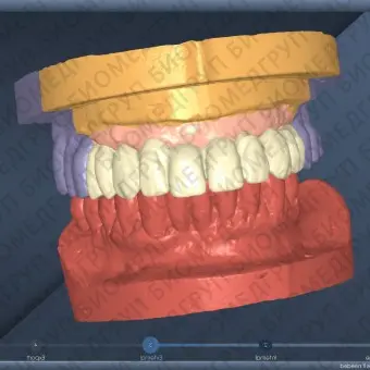 Программное обеспечение для лабораторий DentalCad