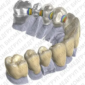 Программное обеспечение для стоматологии exocad