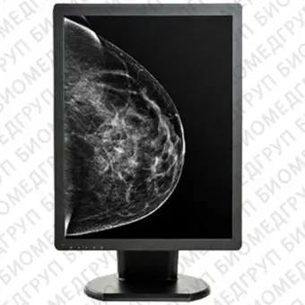 Double Black Imaging 5MP Monochrome Display For Mammography And Tomo Медицинский монитор