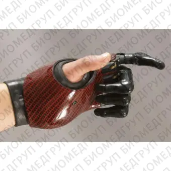 Миоэлектрический частичный протез кисти руки