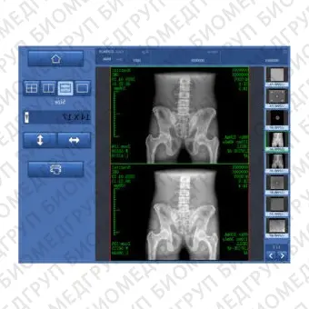 Программное обеспечение для медицинских снимков DXRay