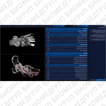 Медицинское программное обеспечение Disior Bonelogic Ortho