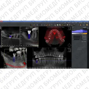 Программное обеспечение для обработки снимков зубов QuickVision 3D