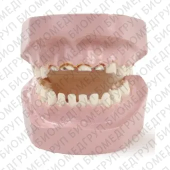 Анатомическая модель прорезывание зубов 79865