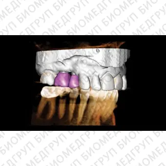 Программное обеспечение для обработки снимков зубов Invivo 6