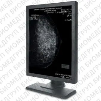 Маммографический монитор M53