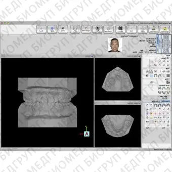 Программное обеспечение для стоматологических лабoраторий Ortho Insight 3D Full / Lite