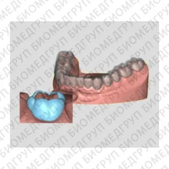 Программное обеспечение для стоматологических лабoраторий DELTAFACE