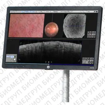 Система диагностики кожи анализ глубоких слоев кожи VivoSight