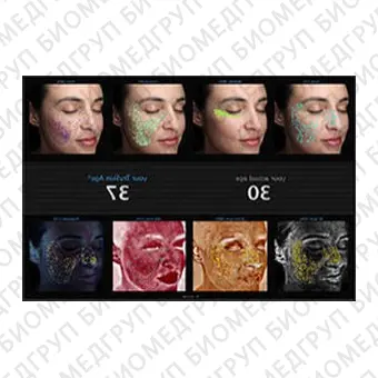 Система диагностики кожи анализа упругости кожи VISIA