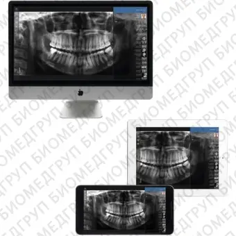 Приложение iOS для обработки снимков зубов Planmeca mRomexis Mobile