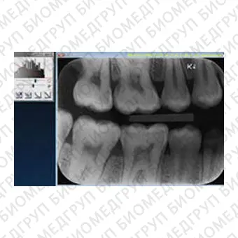 Программное обеспечение для обработки снимков зубов CLINIVIEW