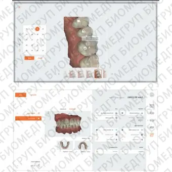 Программное обеспечение для обработки снимков зубов HeronClinic 3.1