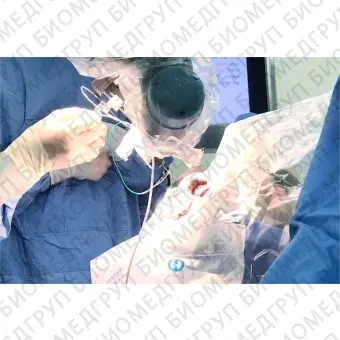 Операционный робот для нейрохирургии Remebot 