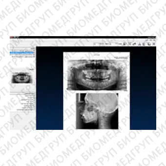 Программное обеспечение для обработки снимков зубов CLINIVIEW