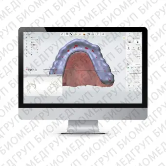 Ортодонтическое программное обеспечение SPLINT STUDIO