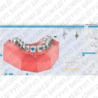 Ортодонтическое программное обеспечение Maestro 3D ortho