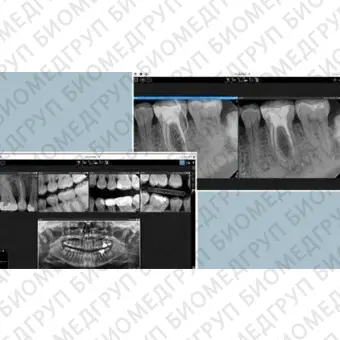 Программное обеспечение для обработки снимков зубов CS Imaging version 8