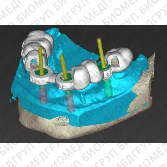 Программное обеспечение для стоматологической хирургии coDiagnostiX