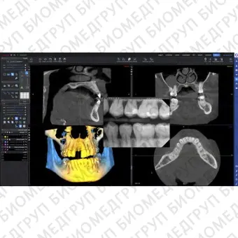 Программное обеспечение для обработки снимков зубов Planmeca Romexis 6.0