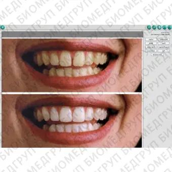 Программное обеспечение для обработки снимков зубов DEXIS