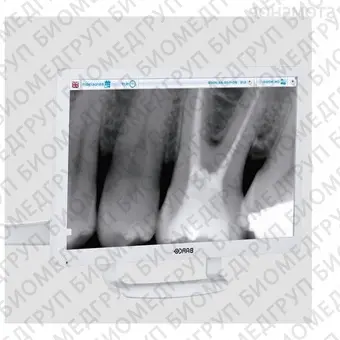 S280  стоматологическая установка с нижней/верхней подачей инструментов