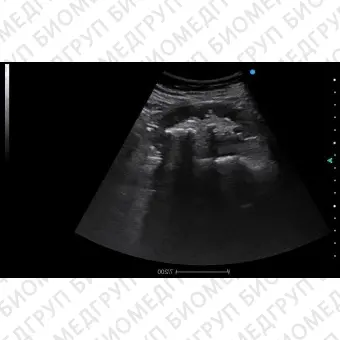 Ультразвуковой сканер переносной, с тележкой Apogee 2300 Urology