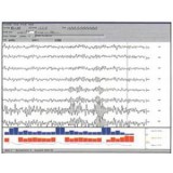 Программное обеспечение для EMG SleepSign™