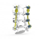 Система остеосинтеза для грудо-пояснично-крестцовой зоны B-Dyn™