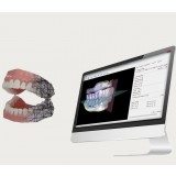 Программное обеспечение для стоматологических лабoраторий BDCreator