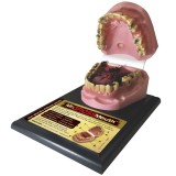 Анатомическая модель прорезывание зубов 79152