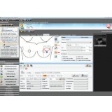 Программное обеспечение для гинекологического обследования NEXUS / OBSTETRICS