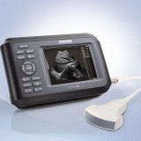 Портативный ультразвуковой сканер Handscan H8