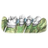 Программное обеспечение для стоматологии Restoration