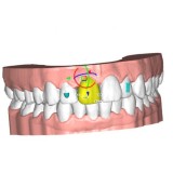 Программное обеспечение для стоматологических лабoраторий ALIGNER