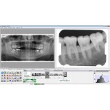 Программное обеспечение для обработки снимков зубов Mediadent