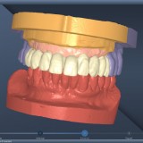 Программное обеспечение для лабораторий DentalCad
