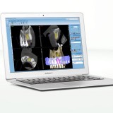 Программное обеспечение для обработки снимков зубов Planmeca Romexis Viewer
