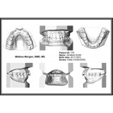 Программное обеспечение для стоматологических лабoраторий Ortho Insight 3D Full / Lite