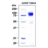Фактор роста гепатоцитов человека, рекомбинантный белок, rhHGF 728AA, Россия, PSG190-50, 50 мкг