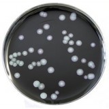 Агар селективный MWY для Legionella, чашки Петри 90 мм, 10 шт/уп, Thermo FS, PO5071A
