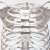 Ортопедическая проволока для закрытия груди STERN FIX