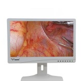 Хирургический монитор YKD-8019