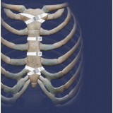 Ортопедическая проволока для закрытия груди Ortholox® UHMWPE